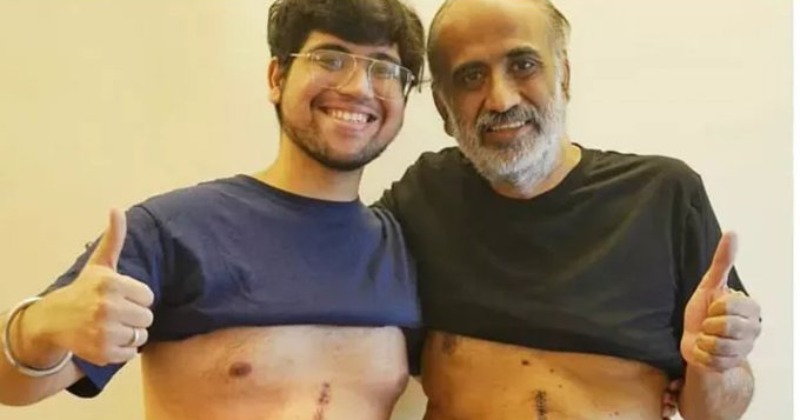 Son Donated 65 Percent Of His Liver To Ailing Dad
