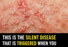 What few people know about this silent disease that can appear without warning